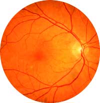 norm retina
